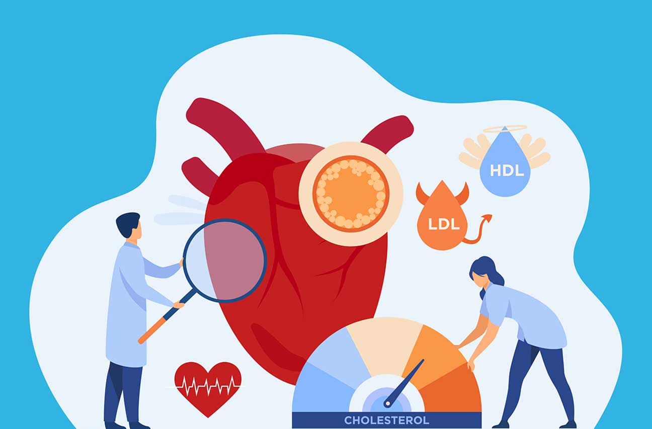 Colesterolo e trigliceridi: impariamo a conoscerli