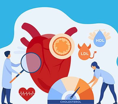 Colesterolo e trigliceridi